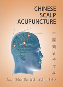 CHINESE SCALP ACUPUNCTURE